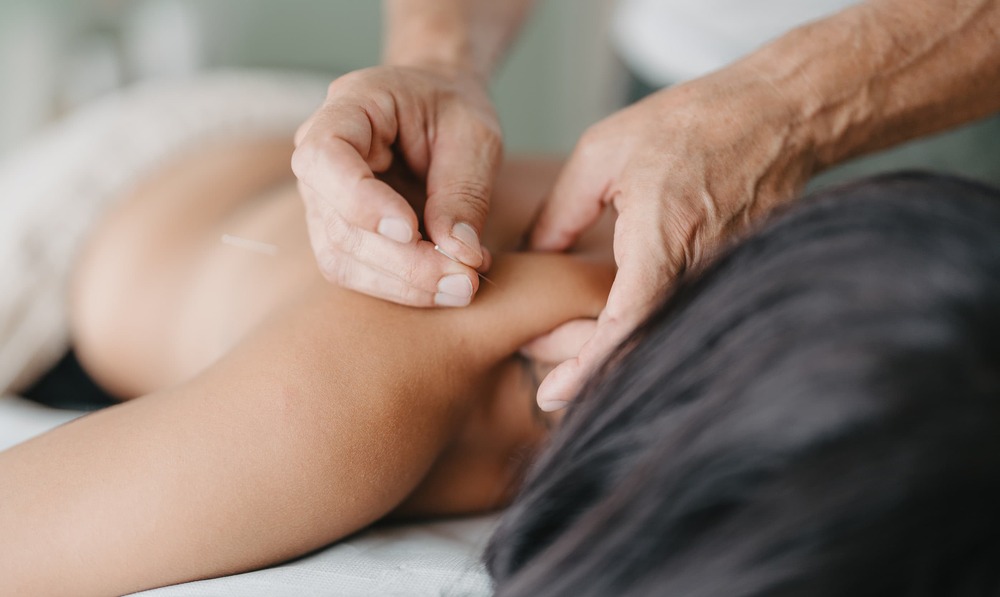 What is Acupuncture and How Does it Work?